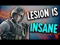 The CRAZIEST Lesion play EVER