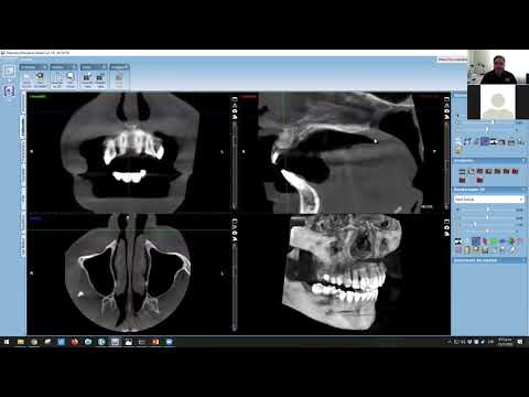 Vídeo: Es pot grapar Romex a la part inferior de les bigues del sòl?