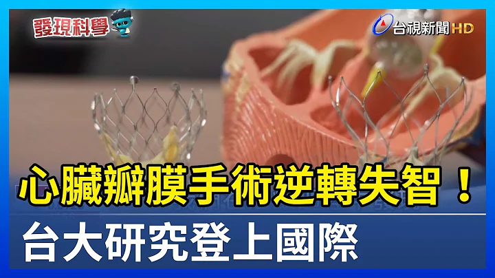 心脏瓣膜手术逆转失智！台大研究登上国际【发现科学】 - 天天要闻