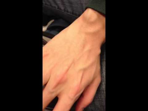 Moving veins on the dorsum of your hand. 
