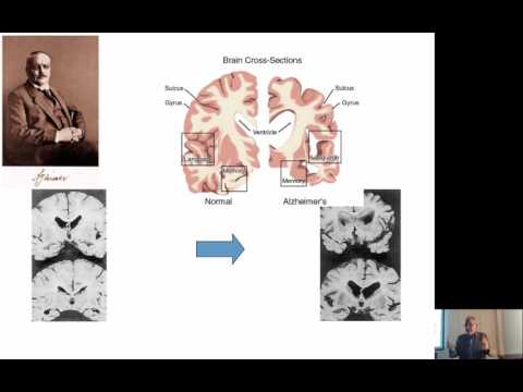 Vidéo: Thérapie Antivenimeuse: Efficacité De La Prémédication Pour La Prévention Des Effets Indésirables