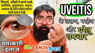 UVEITIS Symptoms, Causes, Signs and Treatment in hindi | Anterior uveitis | Eye treatment at home