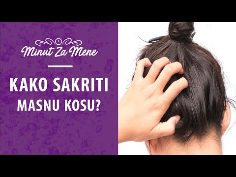 3 trika kako sakriti masnu kosu? | Minut za Mene