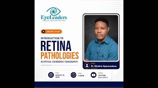 INTRODUCTION TO RETINA PATHOLOGIES IN OPTICAL COHERENCE TOMOGRAPHY