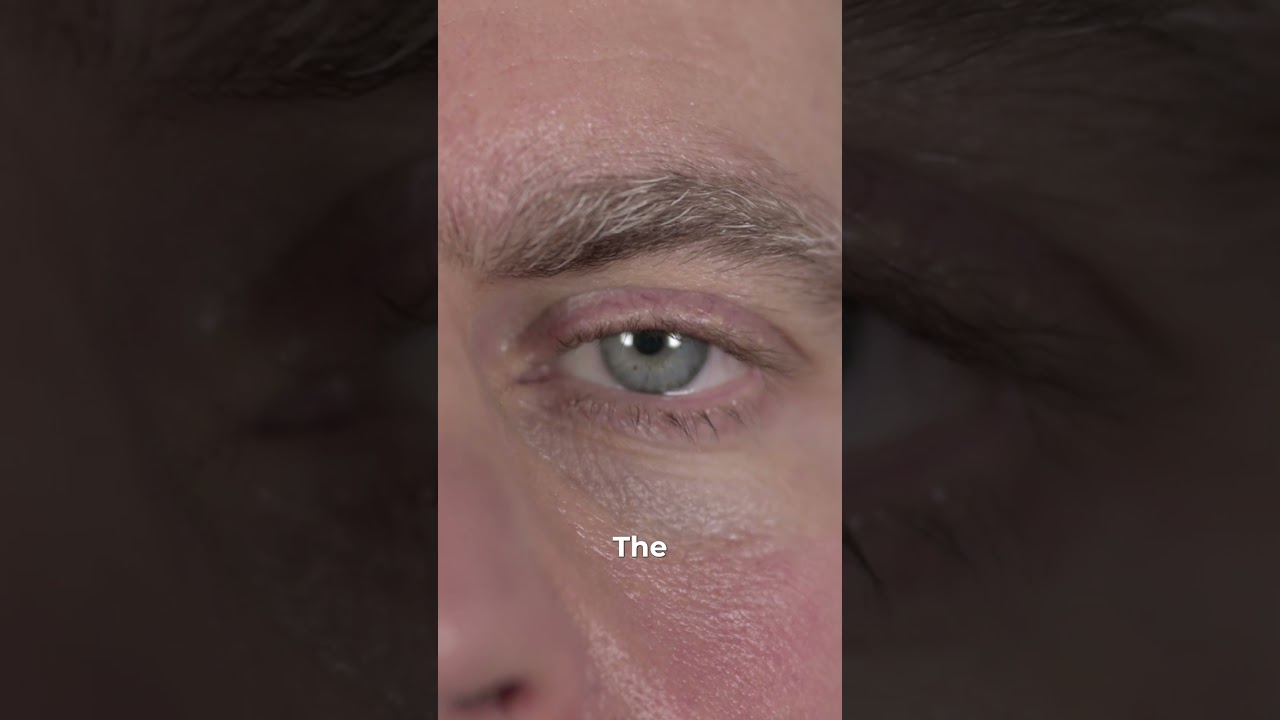 Are You Developing Cataracts?