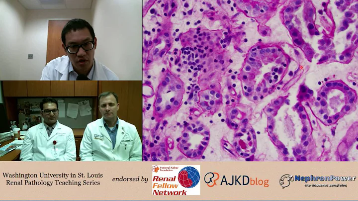 Web Episode #009 -TRANSPLANT! Renal Pathology Teaching Series (Dr. Gaut and Dr. Gupta).
