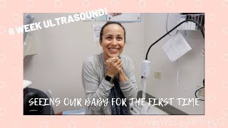 8 WEEK ULTRASOUND! | SEEING OUR BABY FOR THE FIRST TIME