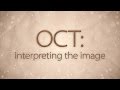 OCT: Interpreting the image