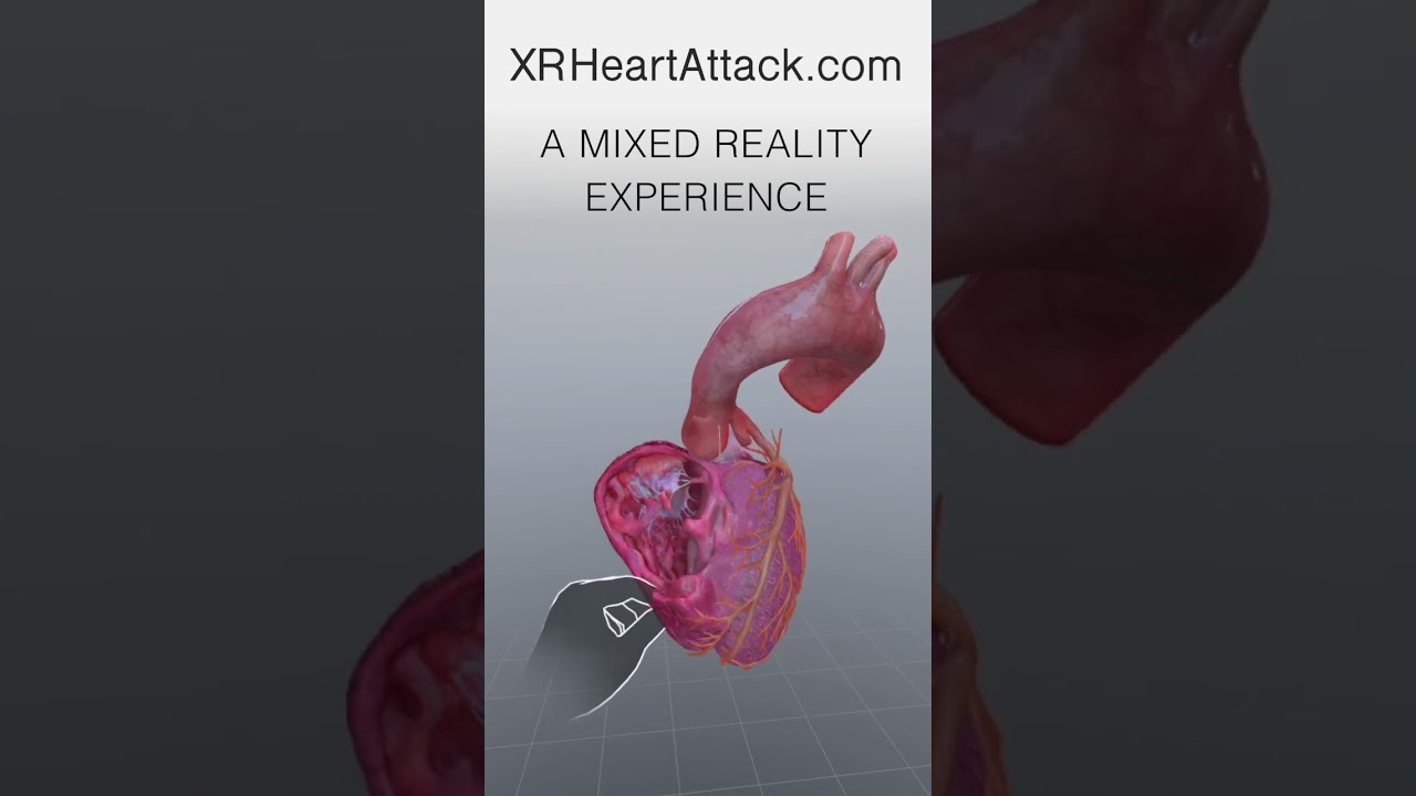 Heart Attack in Mixed Reality #metaquest #mixedreality #quest3 #XR #xrheartattack