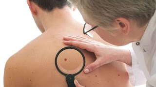 Mesothelioma Asbestos | Mesothelioma: What is asbestos? - Online Mesothelioma Reviews