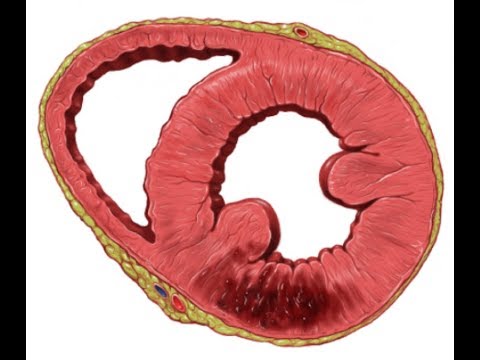 Video: Mis on eutrofeerumine ökoloogias?