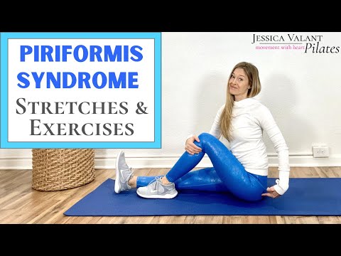 Piriformis Syndrome Stretches and Exercises for Pain Relief