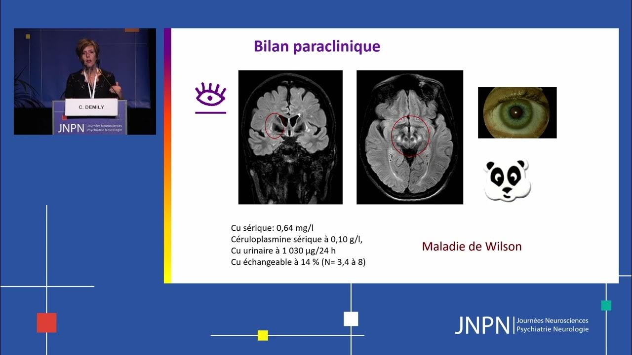 Comment la maladie de Wilson interrogetelle les neurosciences et l