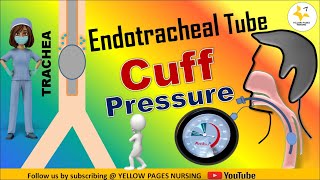 Endotracheal Cuff Pressure I Et Cuff Pressure Monitoring I Factors Affecting Et Cuff Pressure