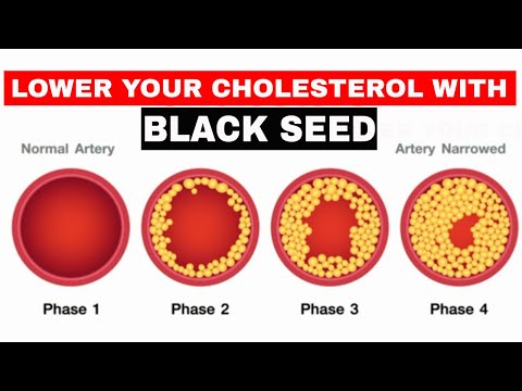 Is Black Seed Effective In Lowering Cholesterol?