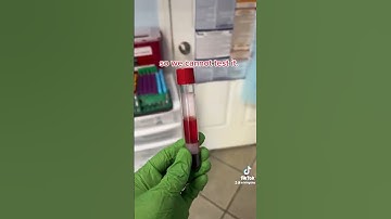 Hemolysis of blood samples.