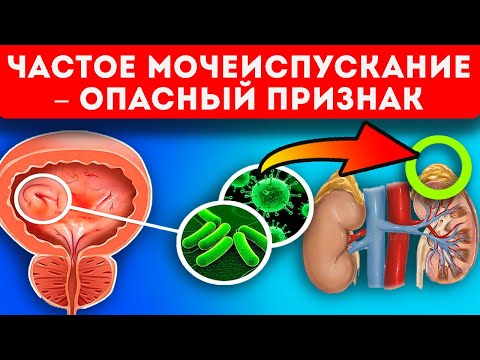 Если ходишь в туалет чаще ... раз! Проблемы почек, мочевого пузыря и даже...