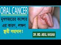 মুখগহ্বরের ক্যান্সার (Oral Cancer) হোমিওপ্যাথি সমাধান।