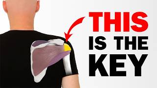 The KEY To Fixing Rotator Cuff Tendinitis & Tears For Good