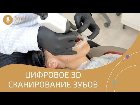 Зачем стоматологу интраоральный сканер зубов | CAD/CAM технологии | Bauers Dental Store