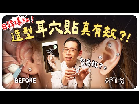 日韓爆紅耳穴貼！是有效還是智商稅？2000年前的古法中醫師踢爆！｜侑達大師