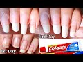 In Just 3 Days Nails Grow with Colgate||How to grow nails fast||Faster nails growth tips
