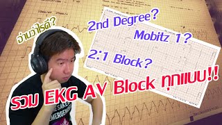 รวม EKG AV Block ทุกแบบ!! [AV Block Part 3/4] | Frontline EKG