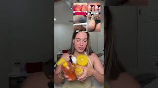 Hyperpigmentation gone #hyperpigmentation #darkspots #discoloration #... #Shorts