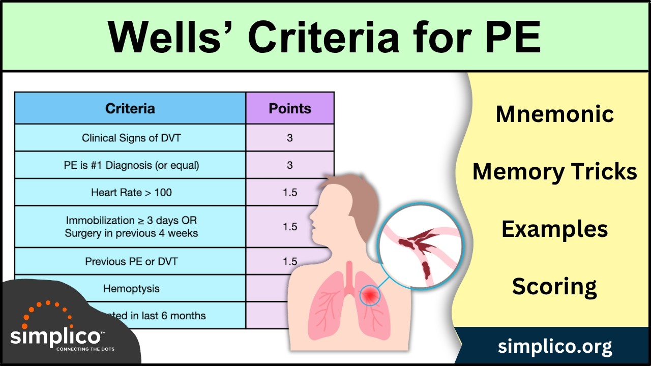 Wells' Criteria for Pulmonary Embolism [Mnemonic] #nursing #emt - YouTube