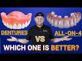 Dentures vs Over-Denture (aka Snap In Denture) vs All-on-4 Dental Implants