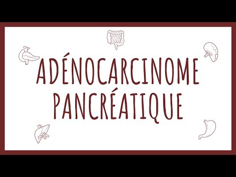 Vidéo: Cancer Du Pancréas (adénocarcinome) Chez Le Chien