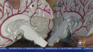 Northwestern University Researcher Working On Brain Chips