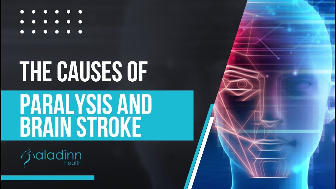 The Causes Of Paralysis And Brain Stroke - YouTube