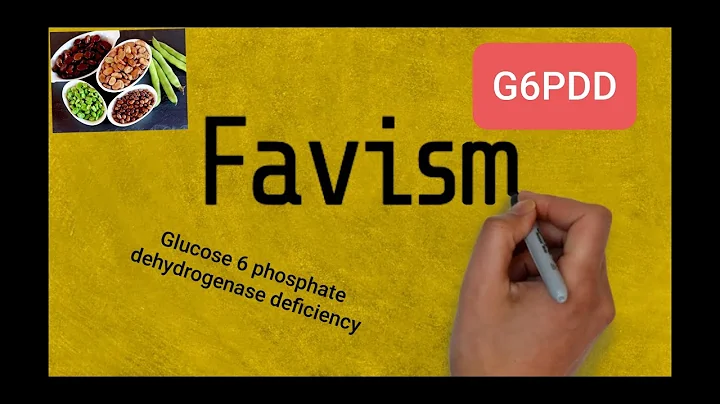 Glucose-6-phosphate dehydrogenase deficiency   G6PDD  Favism  g6pd deficiency