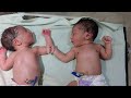 After many days I had twin babies in the hospital | All the baby is absolutely awesome
