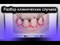 Новые клинические случаи от Чисто деревенского стоматолога