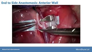 MicroShure Microsurgery Module 8: End to Side Anastomosis
