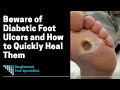 Beware of Diabetic Foot Ulcers and How to Quickly Heal Them