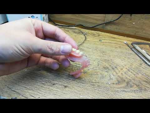 Ремонт съемных зубных протезов своими руками видео