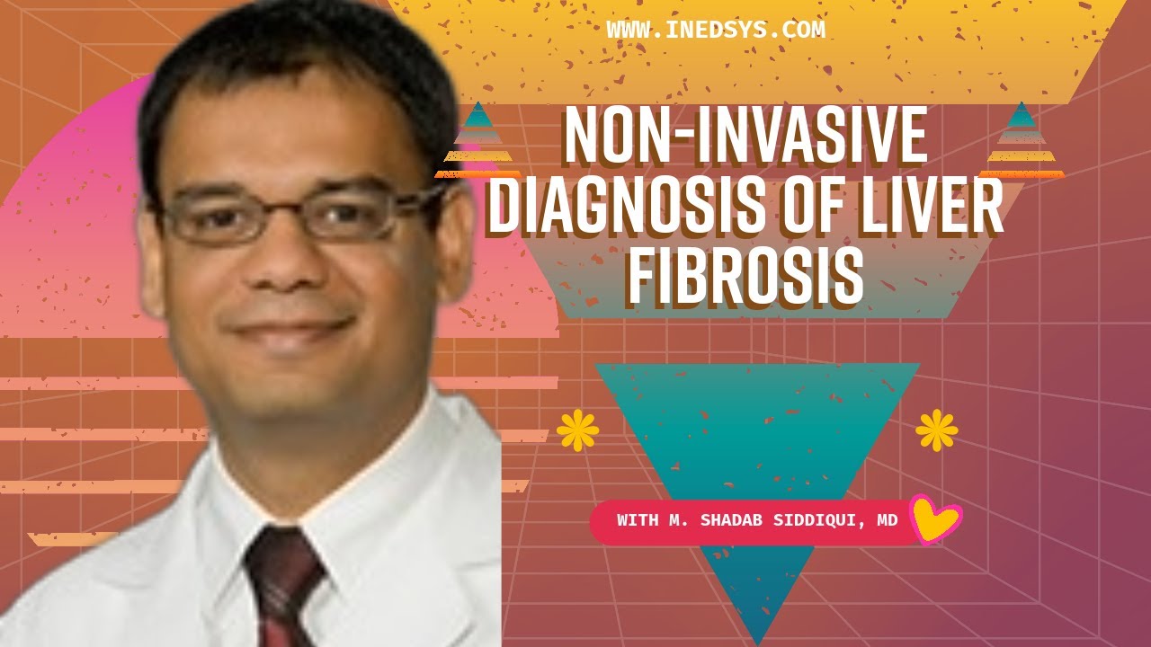 NonInvasive Diagnosis of Liver Fibrosis by Dr. M. Shadab Siddiqui, MD YouTube