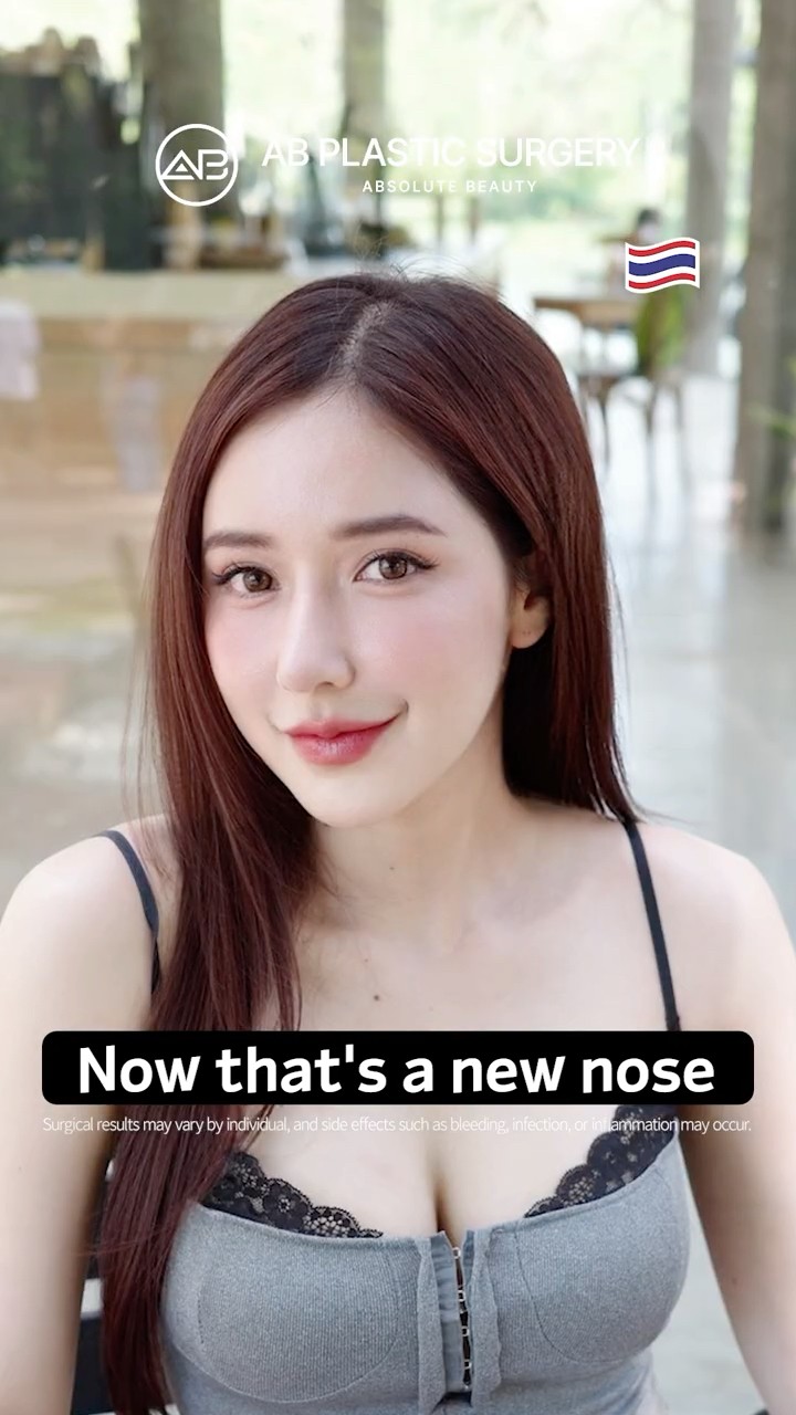 Beautiful, Natural Rhinoplasty Results #shorts