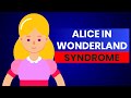 Alice in Wonderland Syndrome (Visual Migraines)