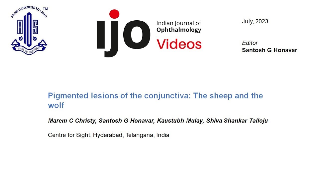 Pigmented lesions of the conjunctiva The sheep and the wolf