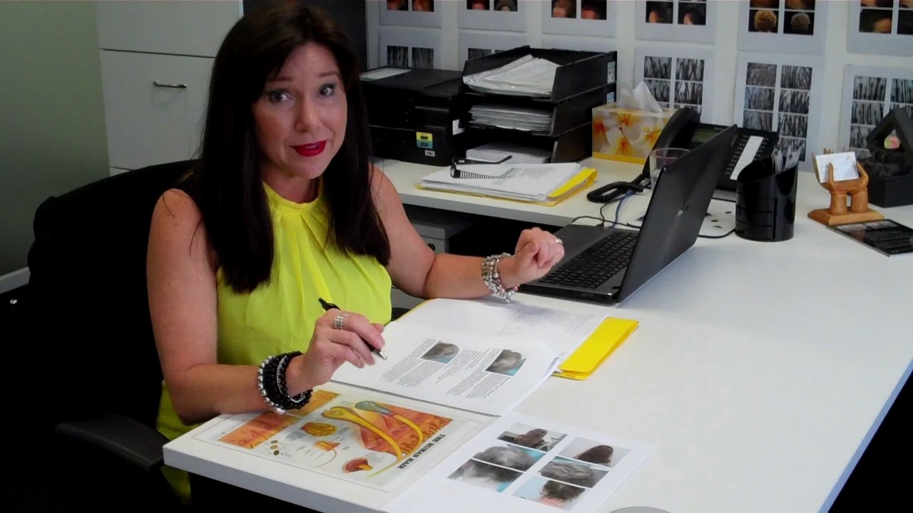 Alopecia Hair Loss Treatment Results