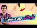 Treatment Of The Double Chin Surgical Non Surgical Options درمان فوری غبغب Treatment Of The Double Chin Surgical Non Surgical Options درمان فوری غبغب