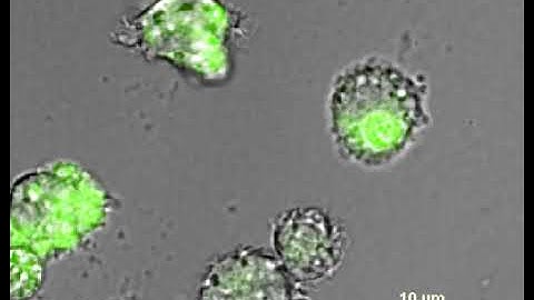 Macrophage Phagocytosis, ROS, microscopy, live cell imaging, Time lapse