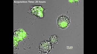 Macrophage Phagocytosis, ROS, microscopy, live cell imaging, Time lapse