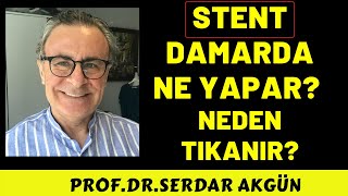 Stent Damar Tıkanıklığı,  Stent ile Açmak, Prof.Dr.Serdar akgün, Serdar akgün , Tıp Videoları