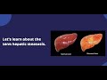 Hepatic steatosis #nclex #rn #nursing #nursingfoundation #liverdisease #hepaticsteatosis #medical