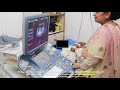 Types of Ultrasound Machine 2026